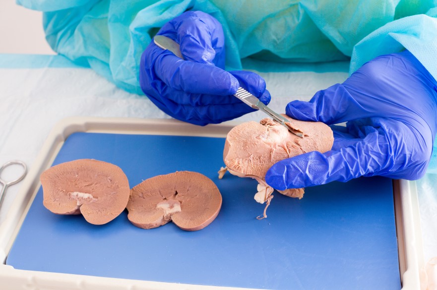 Student wearing blue gloves dissecting a kidney