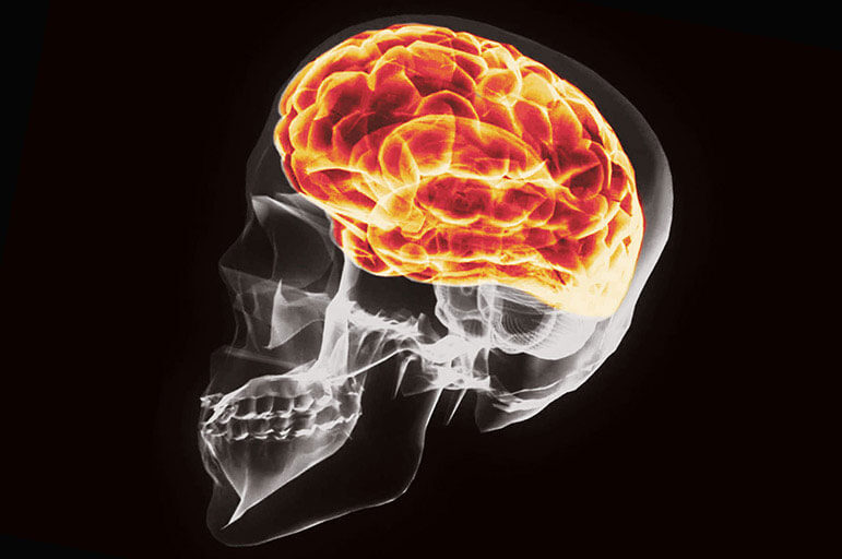 X-ray image of skull and brain