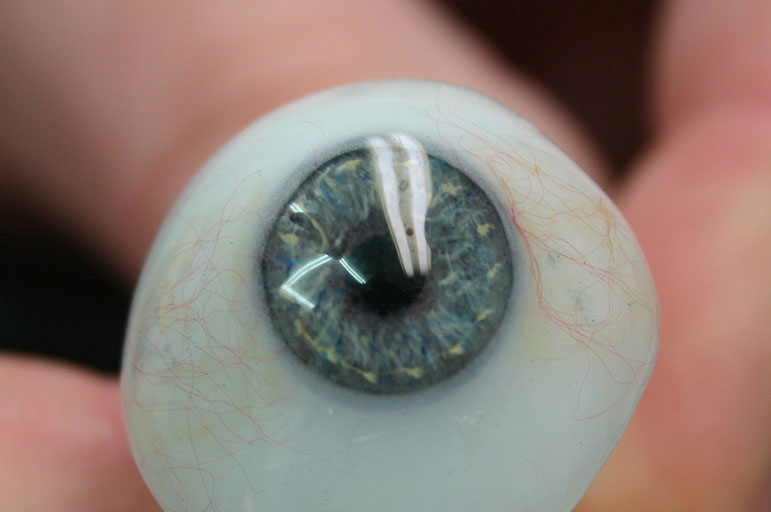 Prosthetic eye