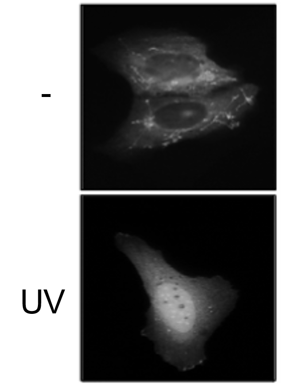 Cancer cell UV image