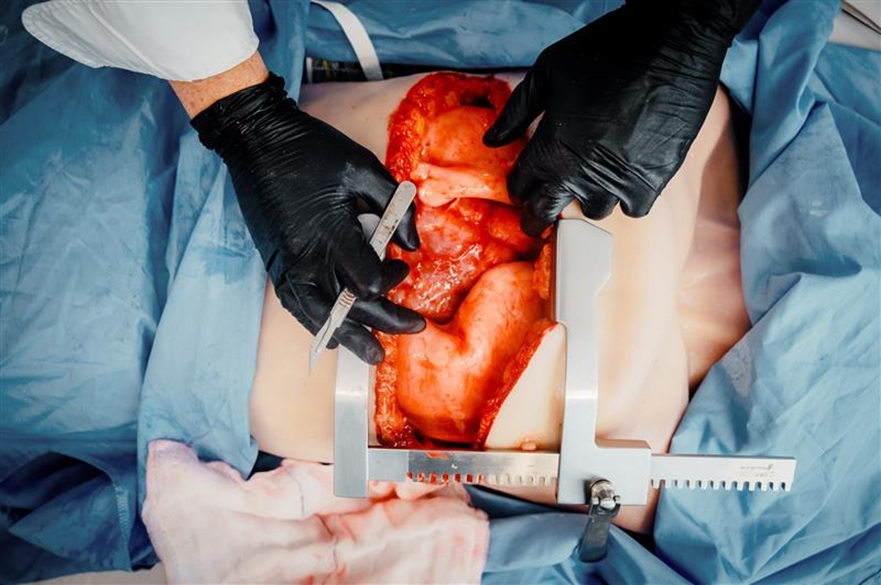 A fake open heart operation