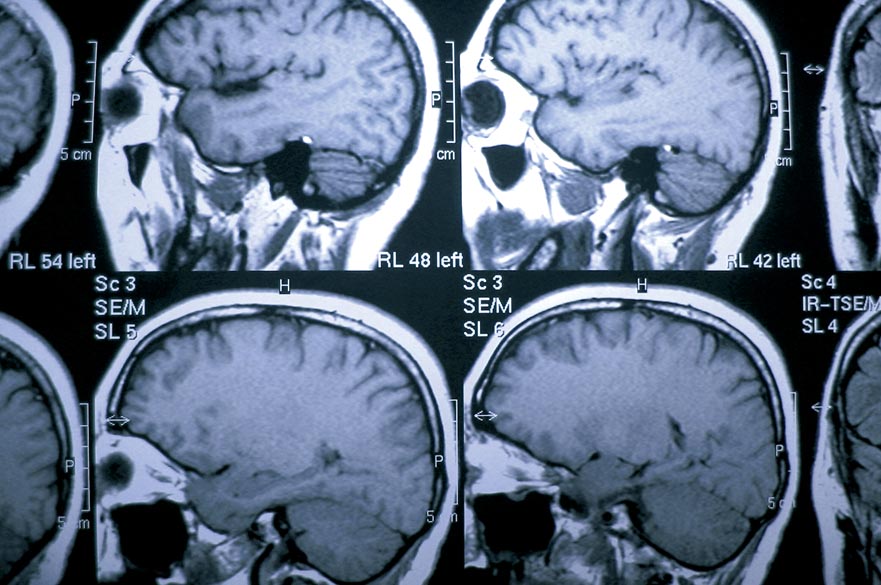 MRI scan sheets