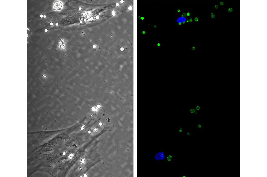 Dr Jehan El-Jawhari - Delivery of Biological Mediators to Mesenchymal Stromal Cells