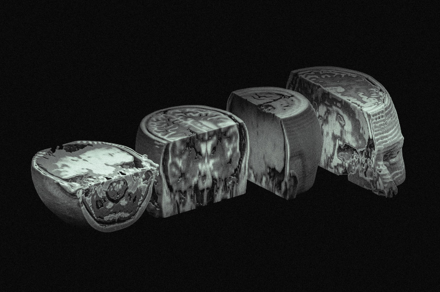 3D scans of a brain