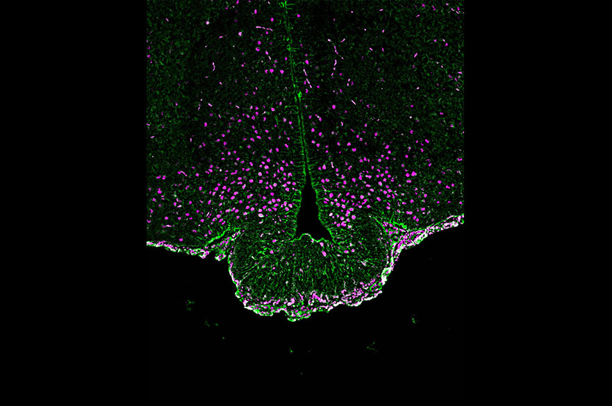 Dr Rebecca Dumbell - Mouse Brain Staining for Proteins of Interest