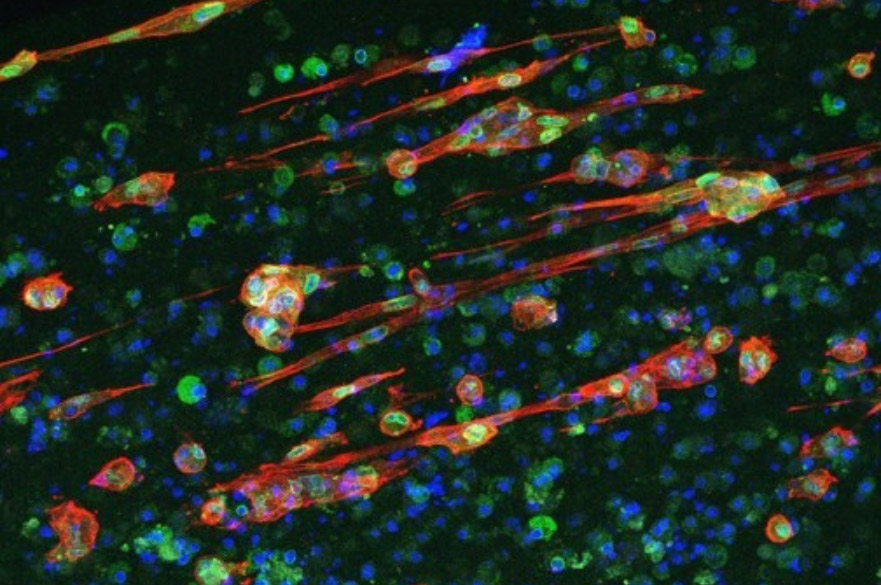 This image captures our laboratories focus on the creation and development of a physiologically relevant animal-free 3D muscle model to be used for drug discovery of sarcopenia. 