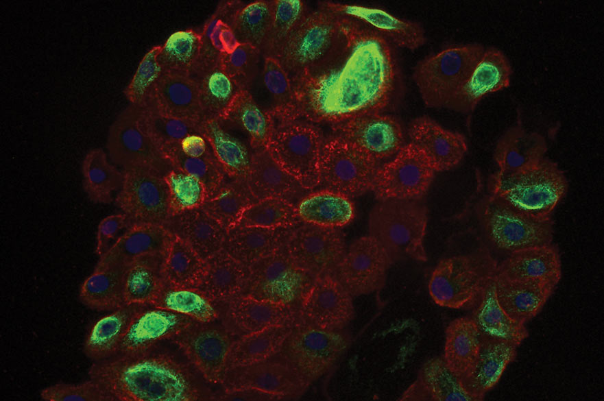 Cancer cells