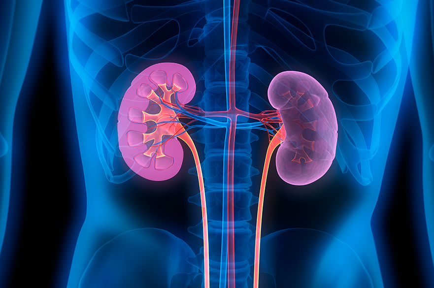 Renal Care header image showing an x-ray with highlighted kidneys