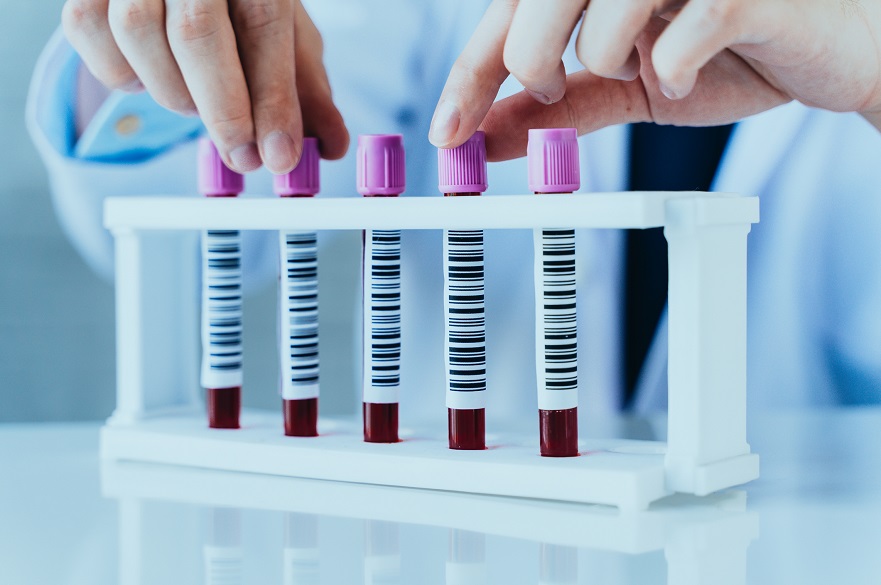 Blood test