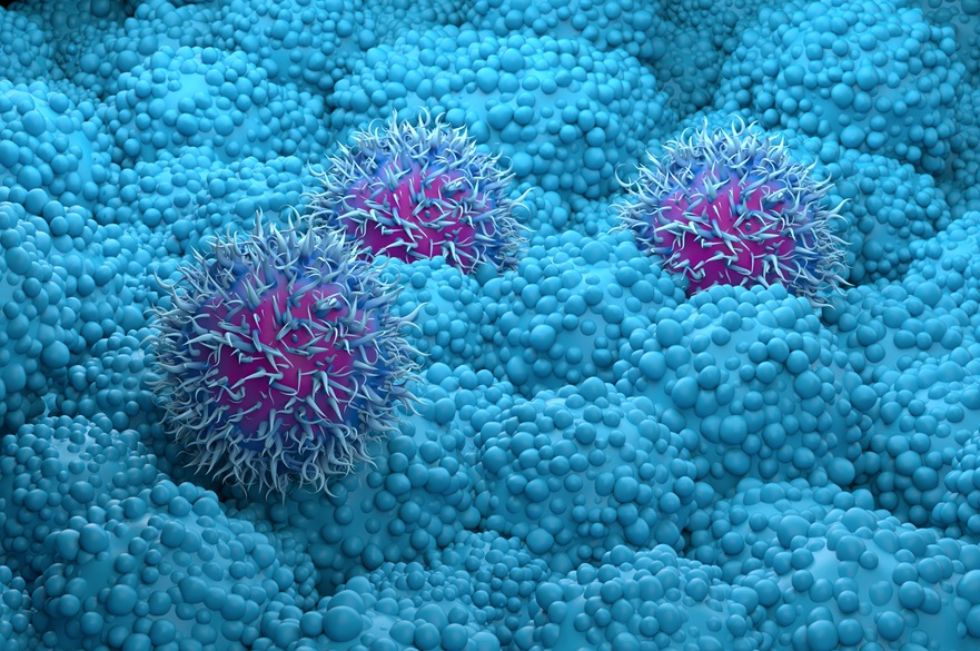 Illustration of pancreatic cancer cells